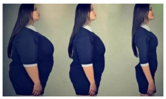 Beyaz bir çerçevenin içerisinde siyah uzun saçlı, siyah giysili bir kadının üç farklı kiloda yandan görünümü yan yana duruyor. Soldaki fazla kilolu fotoğrafta durgun, ortadaki daha az kilolu fotoğrafta daha az durgun ve sağdaki ince görünümlü fotoğrafta mutlu yüz ifadesi olduğu görünüyor.